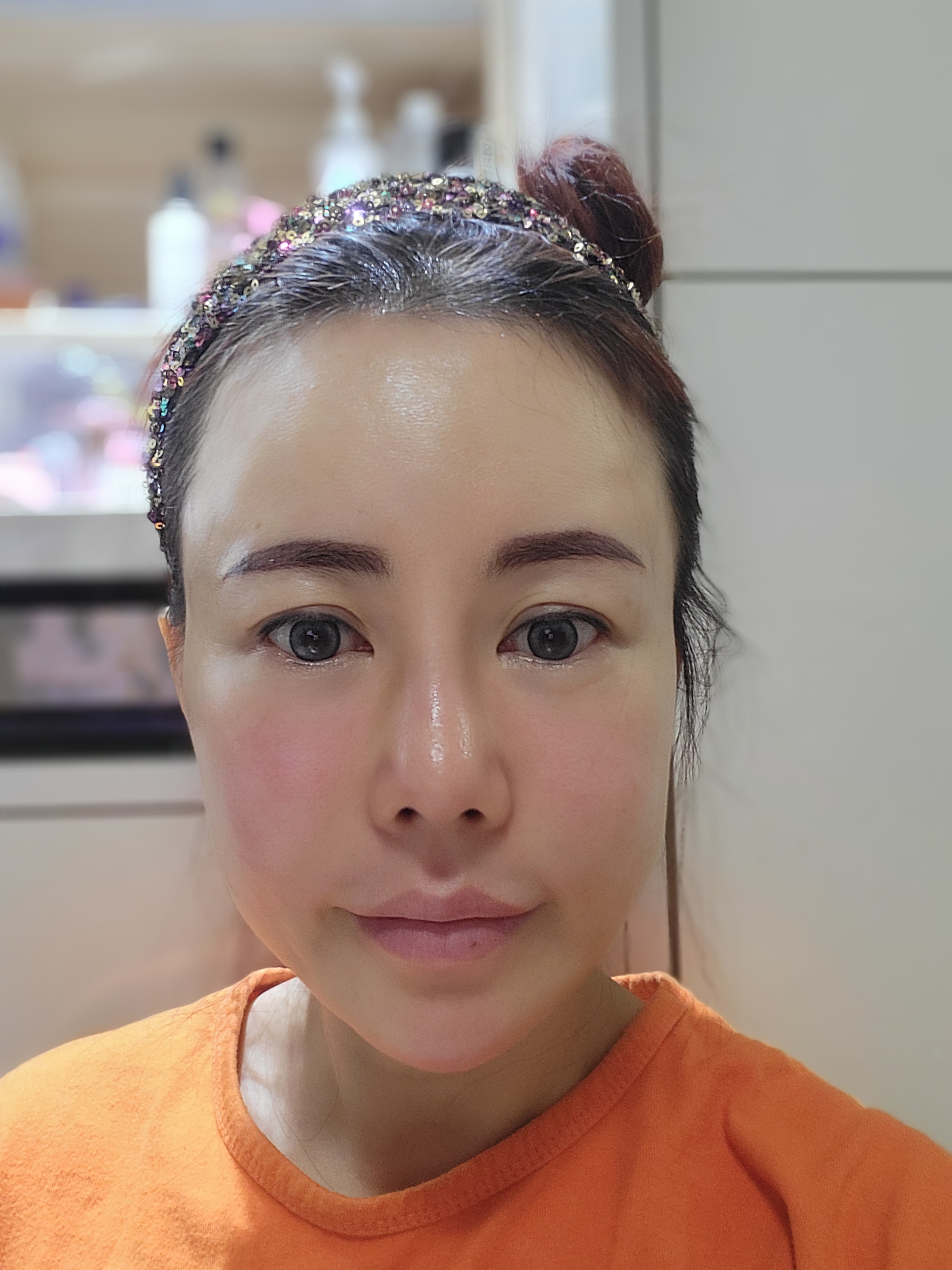 수술후기이미지