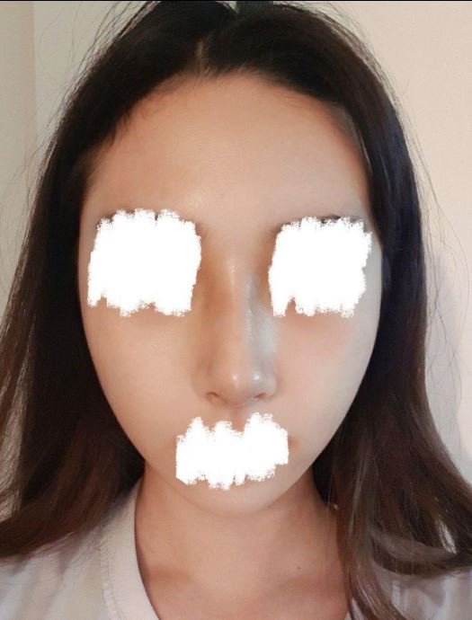 수술후기이미지