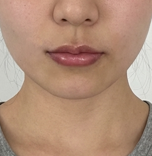 수술후기이미지