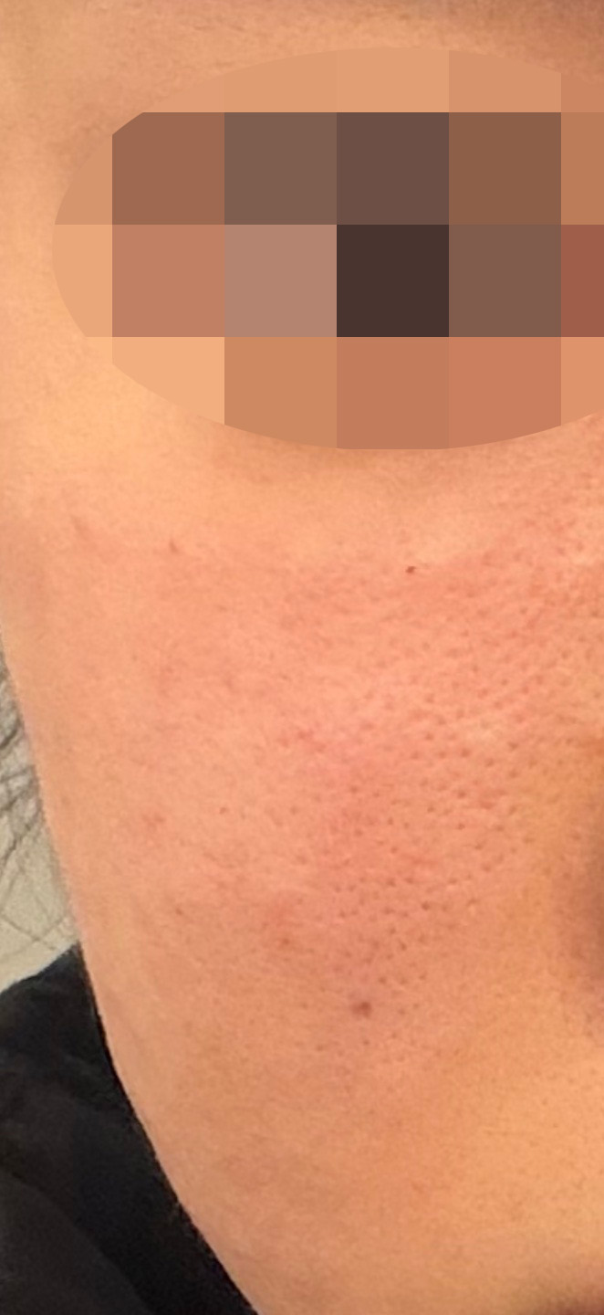 수술후기이미지