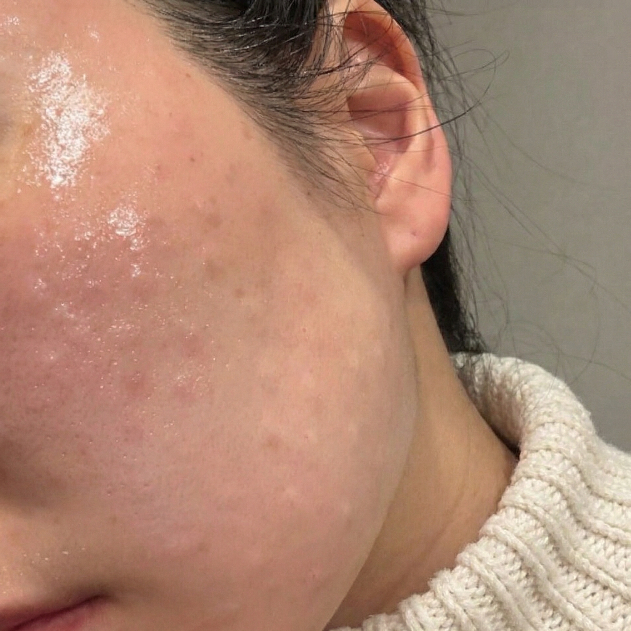 수술후기이미지