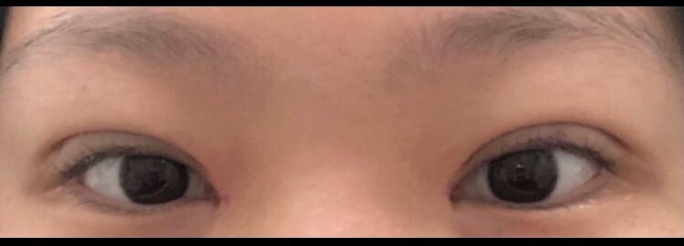 수술후기이미지