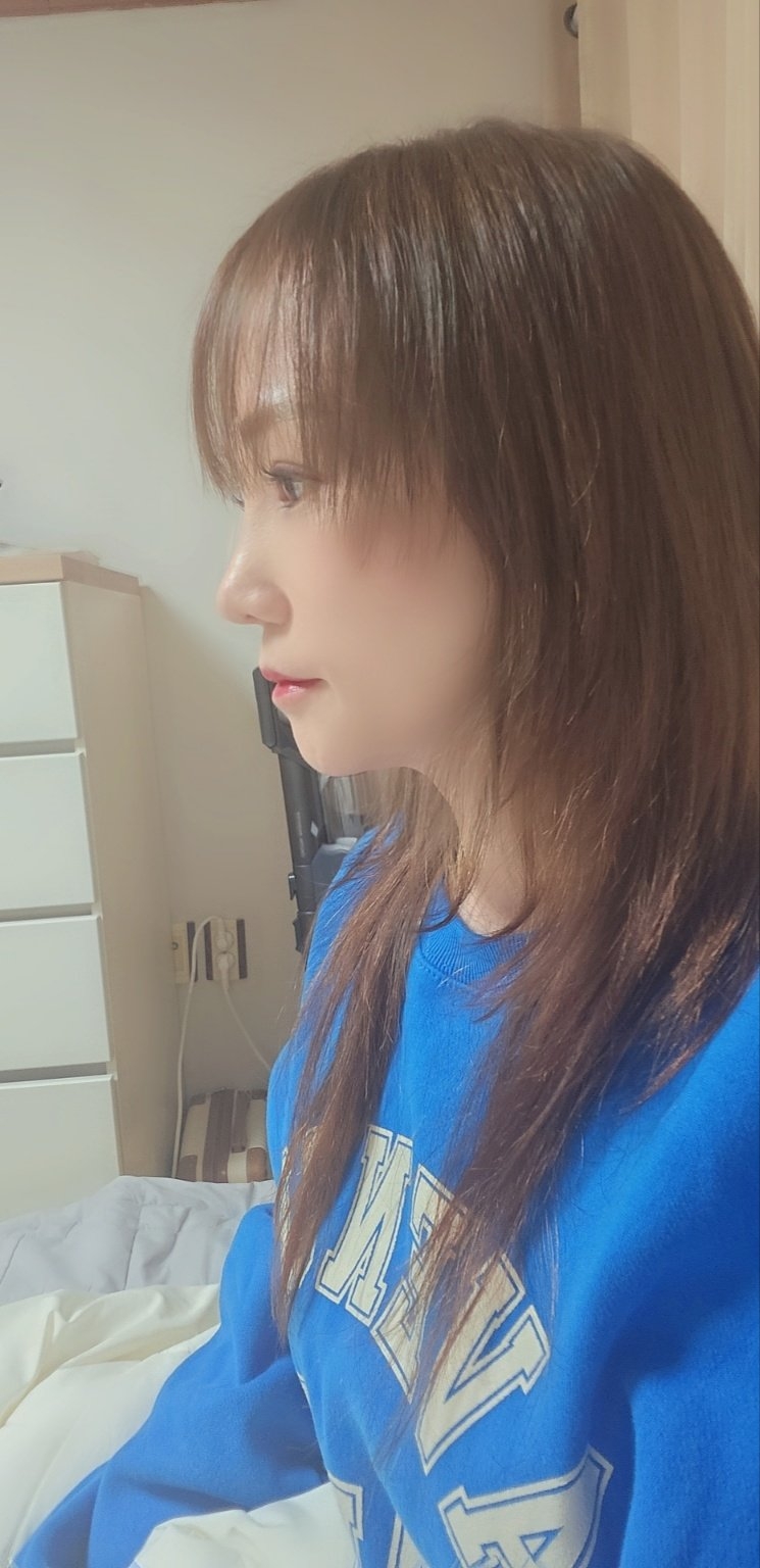 수술후기이미지