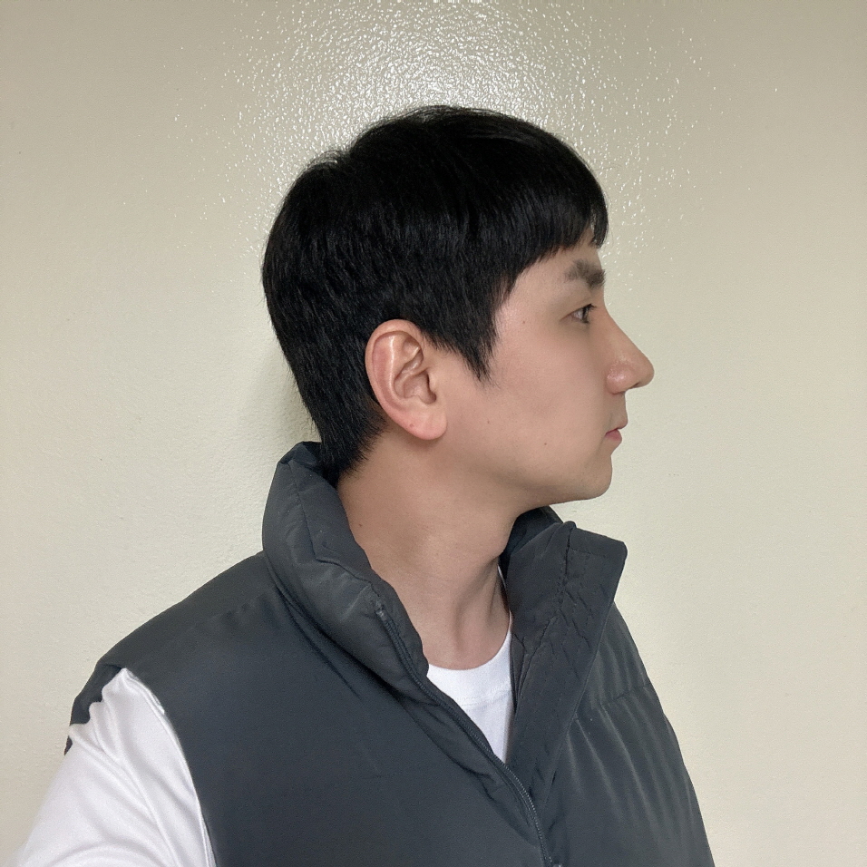 수술후기이미지