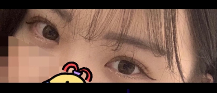 수술후기이미지