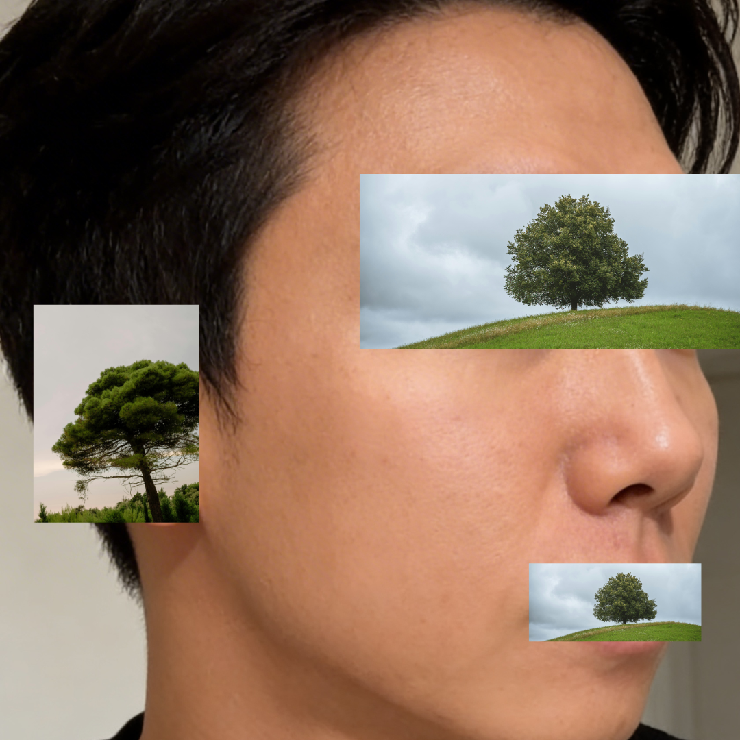 수술후기이미지