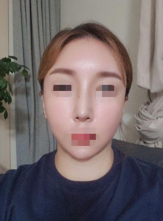 수술후기이미지