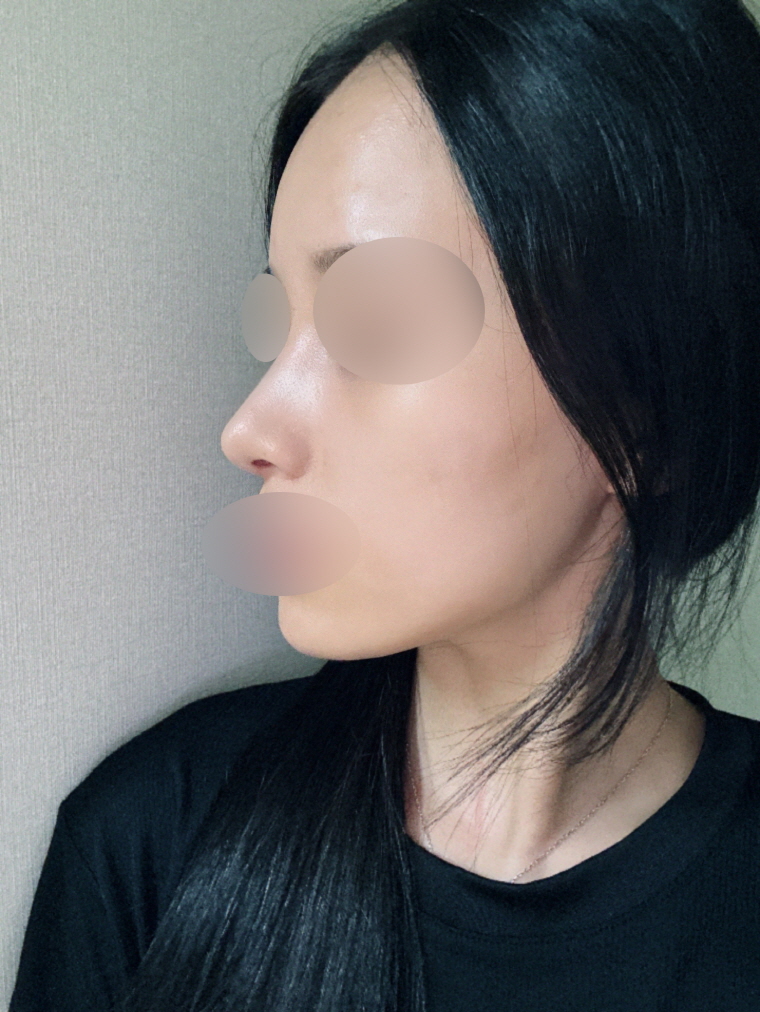 수술후기이미지