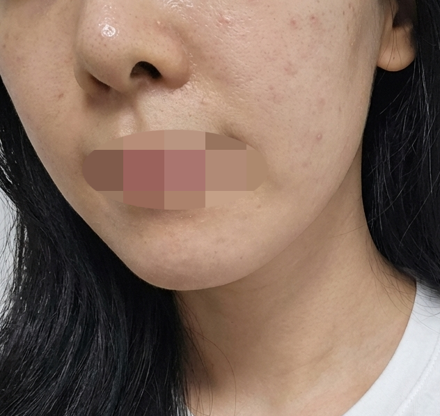 수술후기이미지