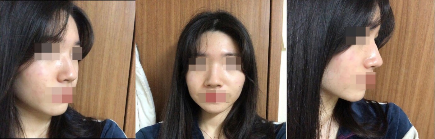 수술후기이미지