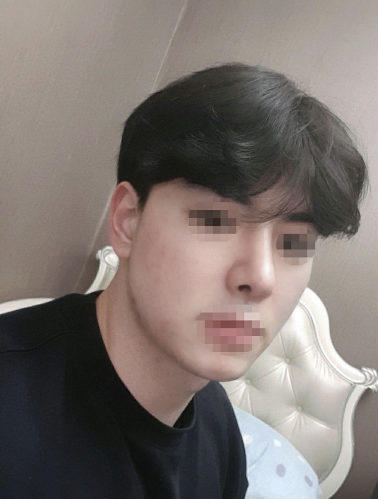 수술후기이미지