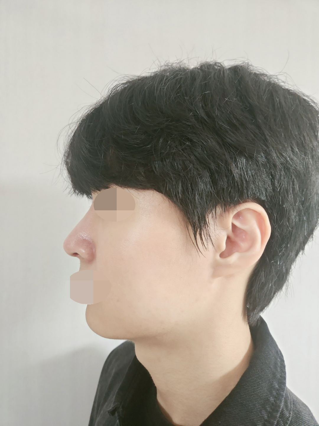 수술후기이미지