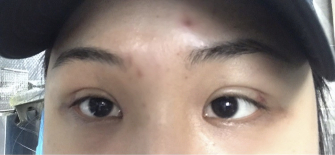 수술후기이미지