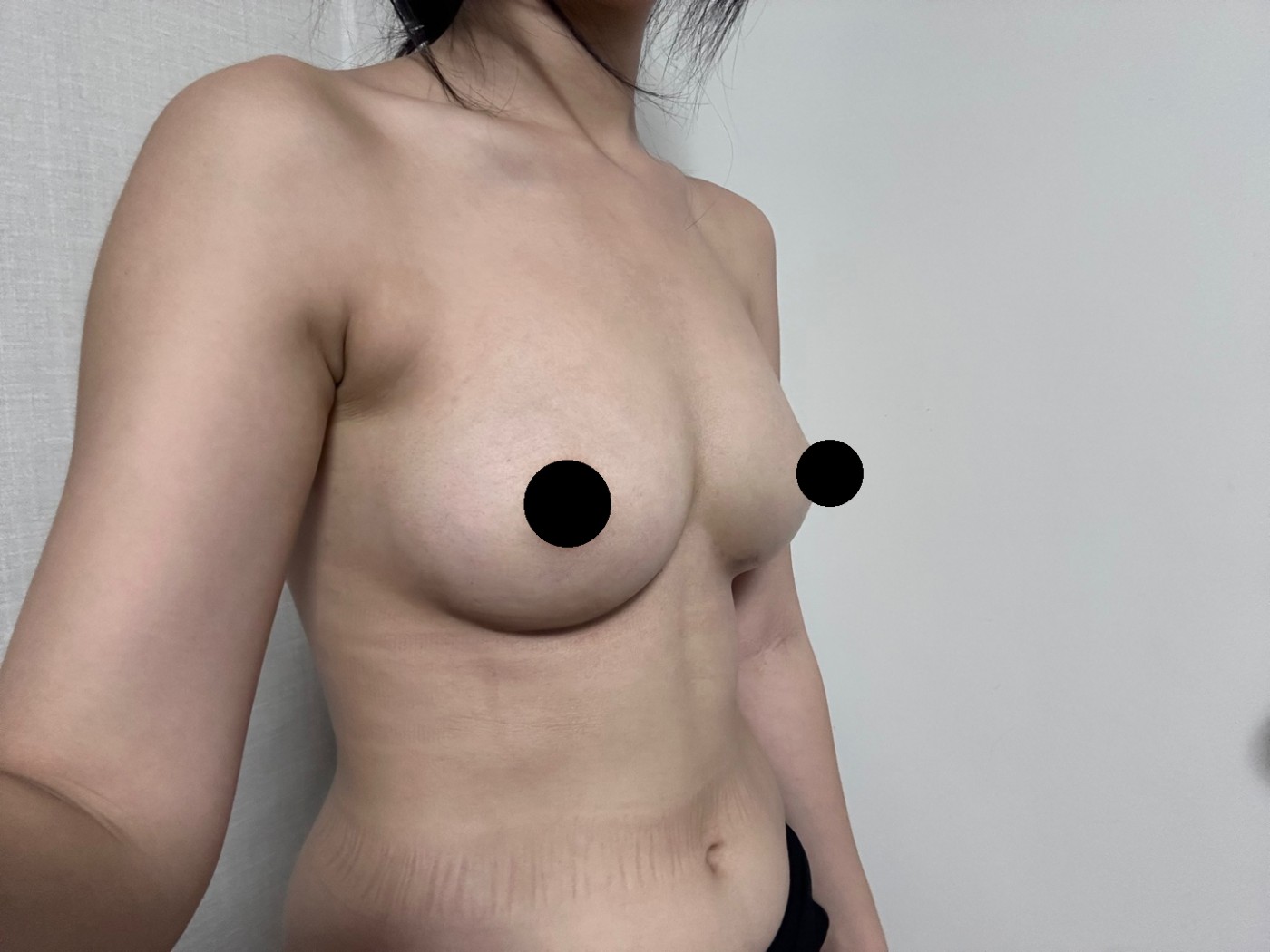 수술후기이미지