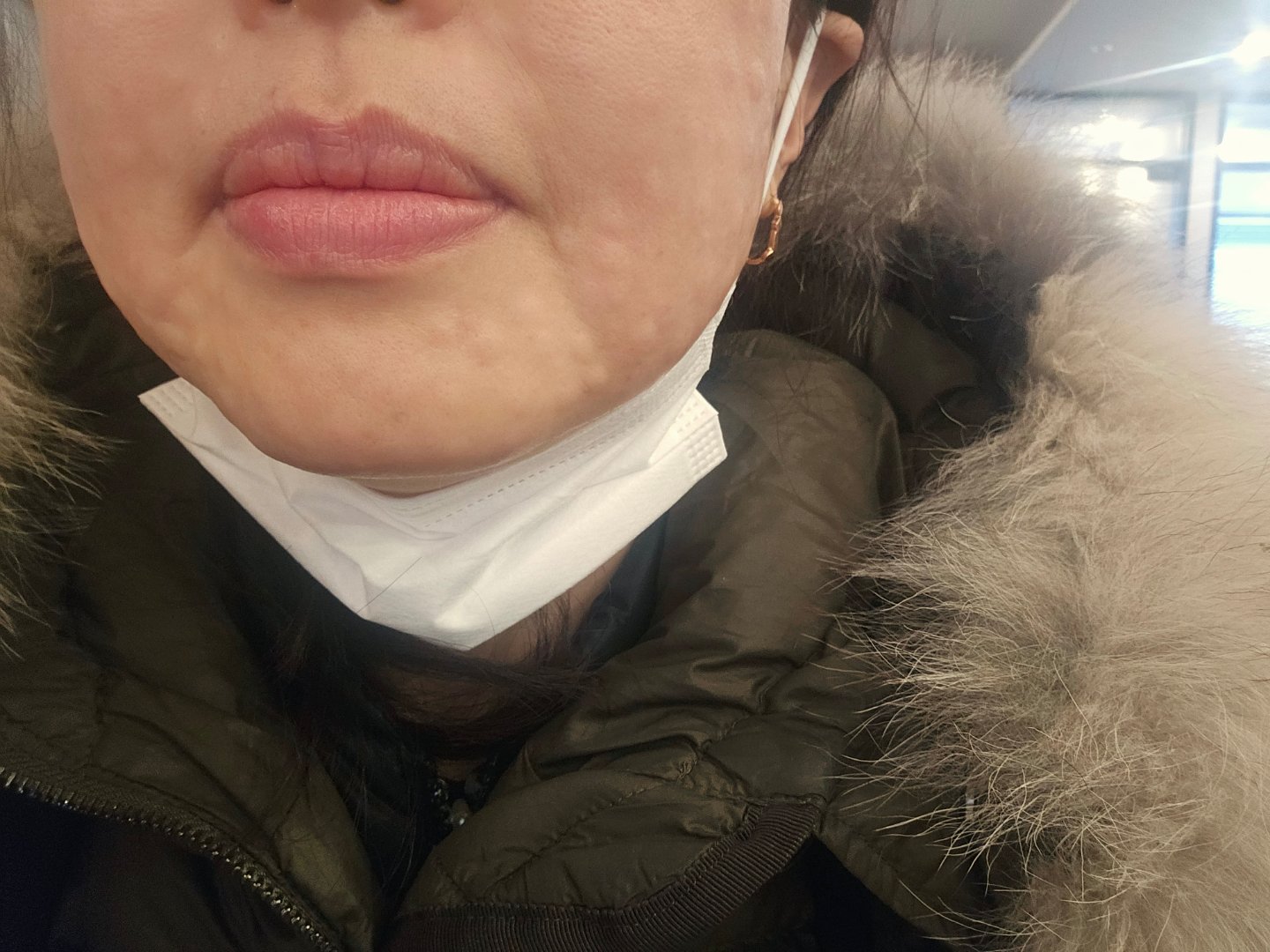 수술후기이미지