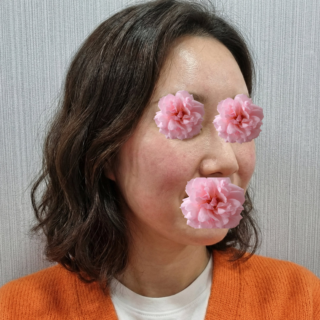 수술후기이미지