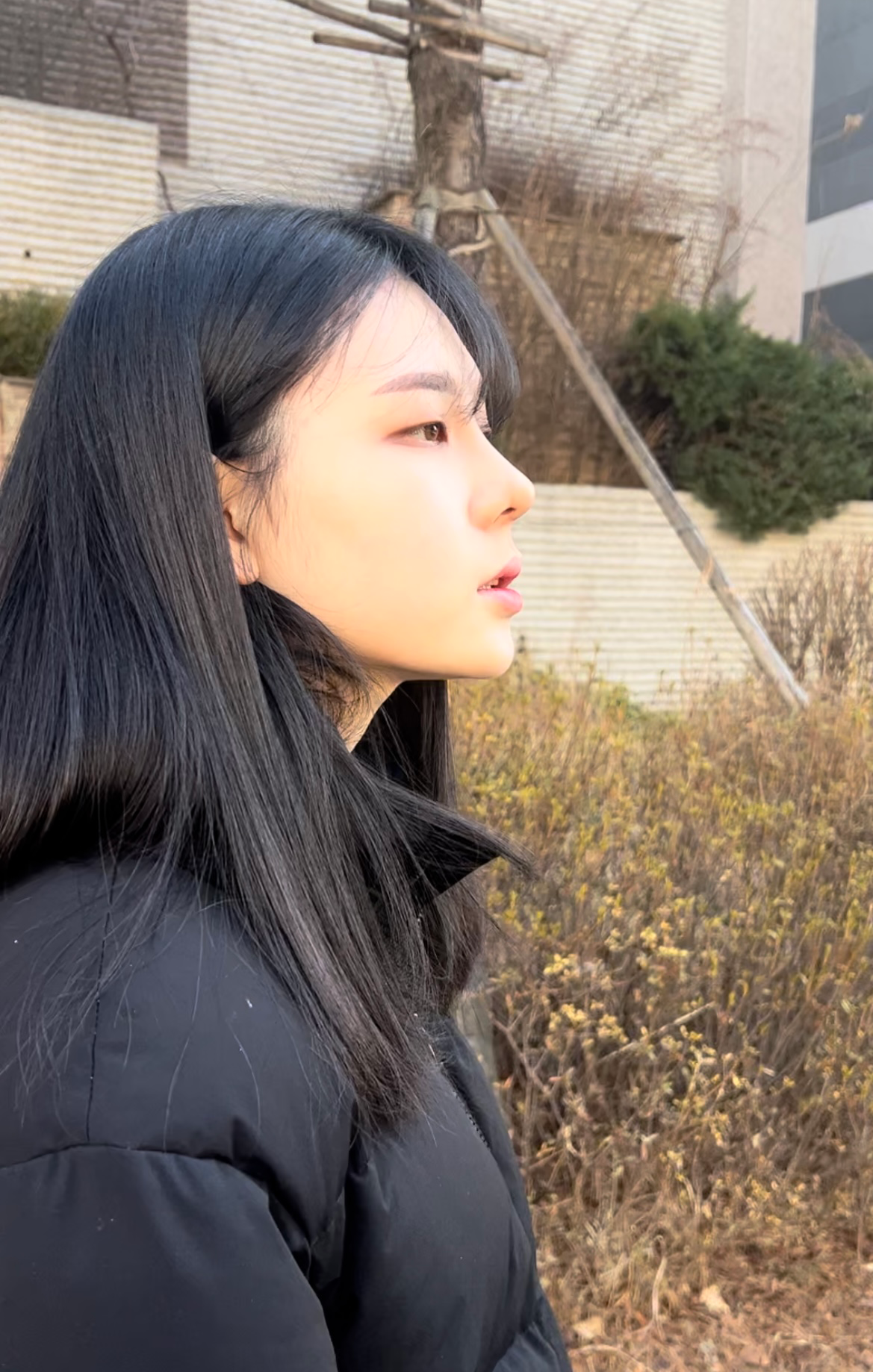 수술후기이미지