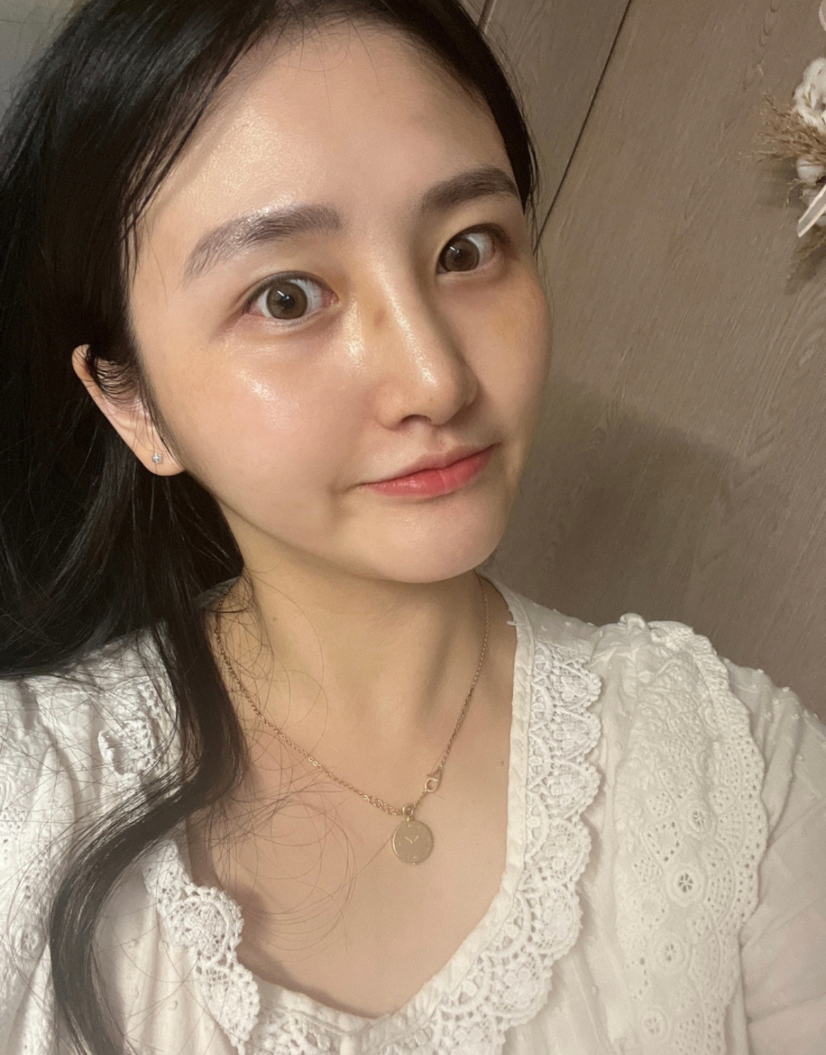 수술후기이미지