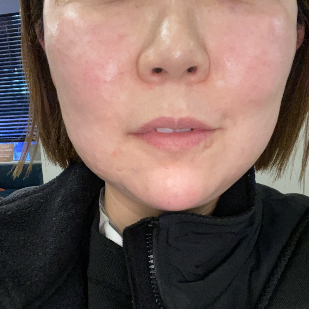 수술후기이미지