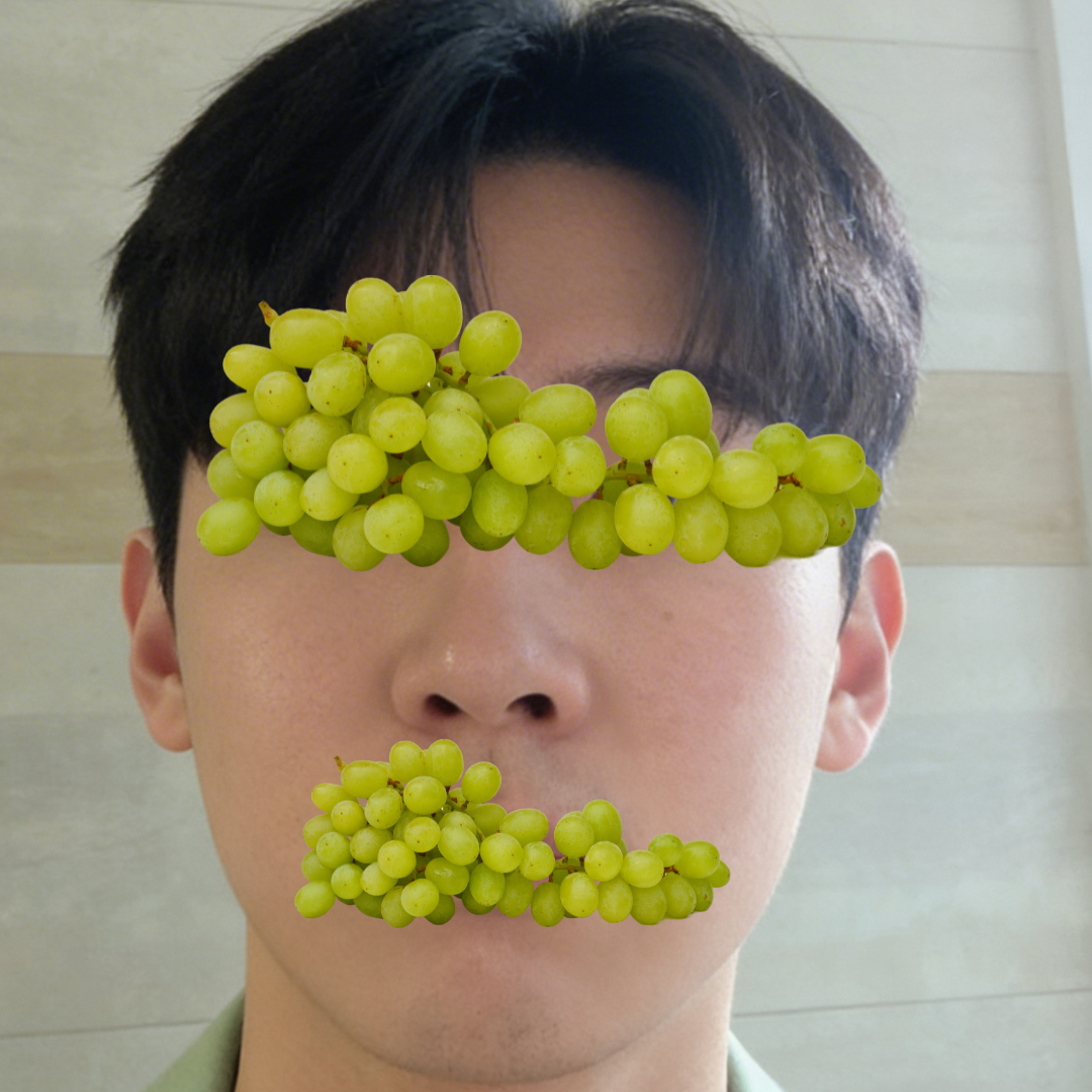 수술후기이미지