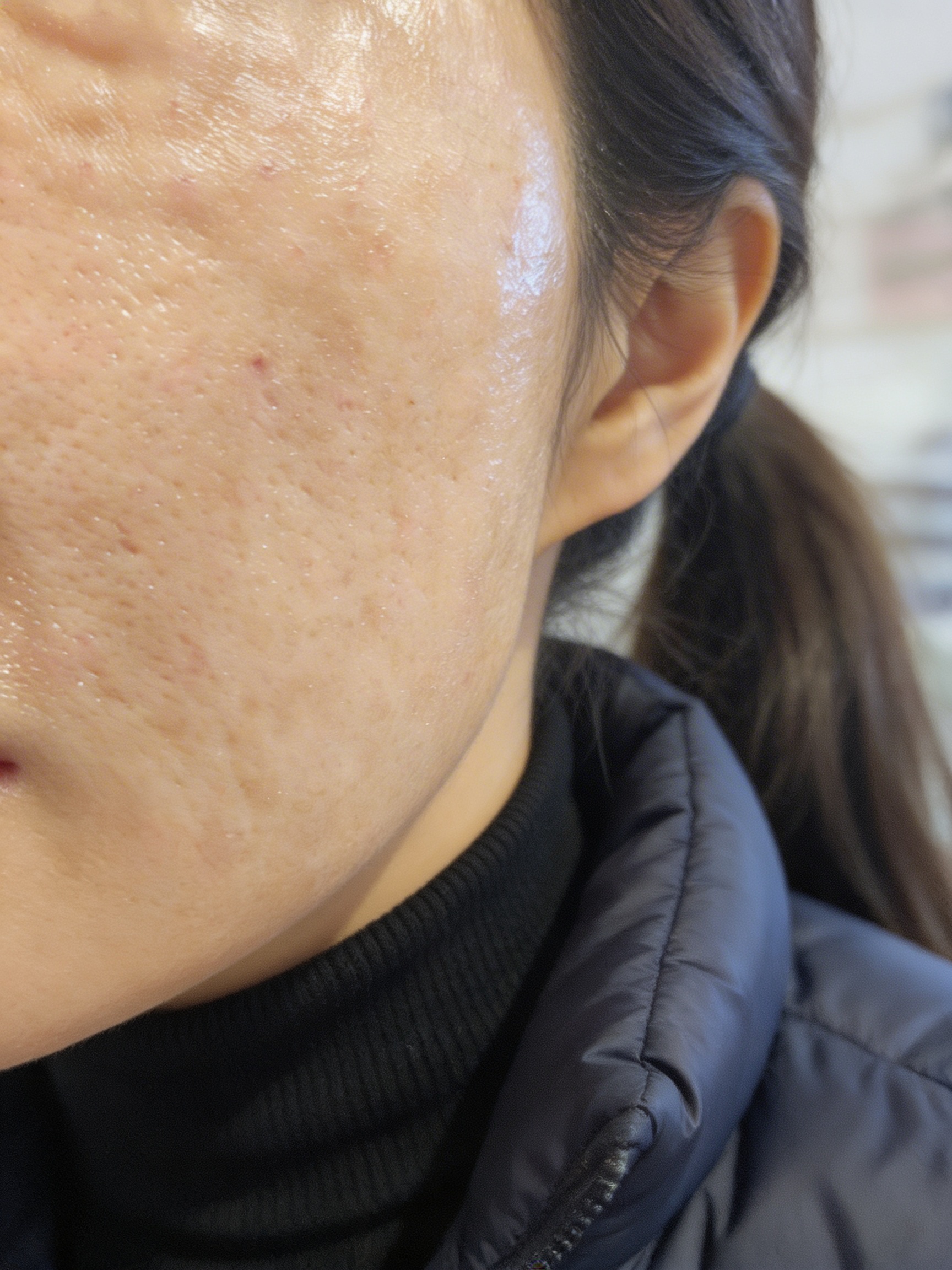 수술후기이미지