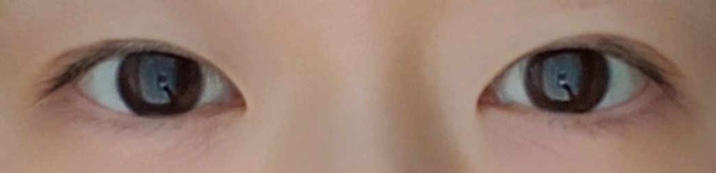 수술후기이미지