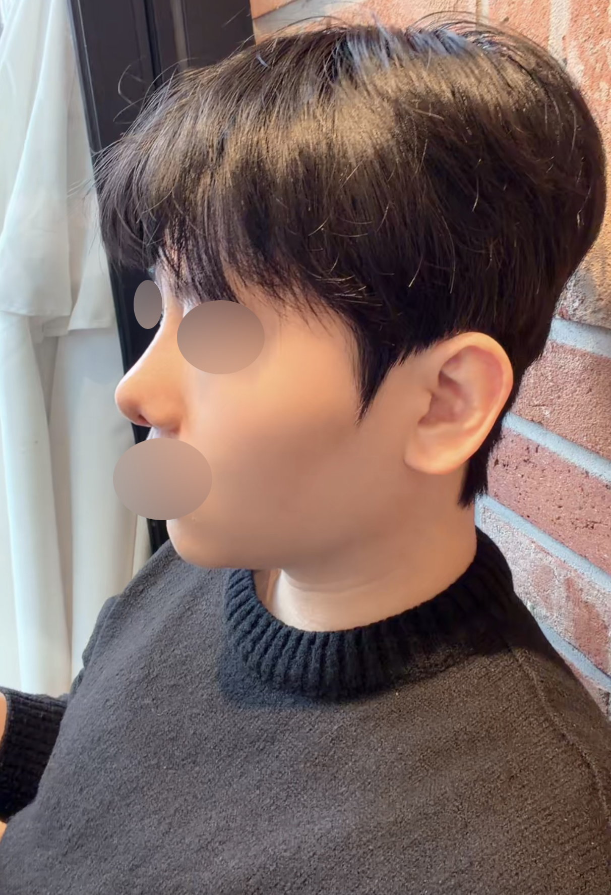 수술후기이미지