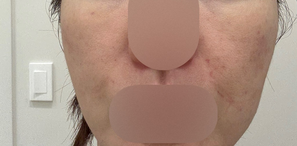 수술후기이미지