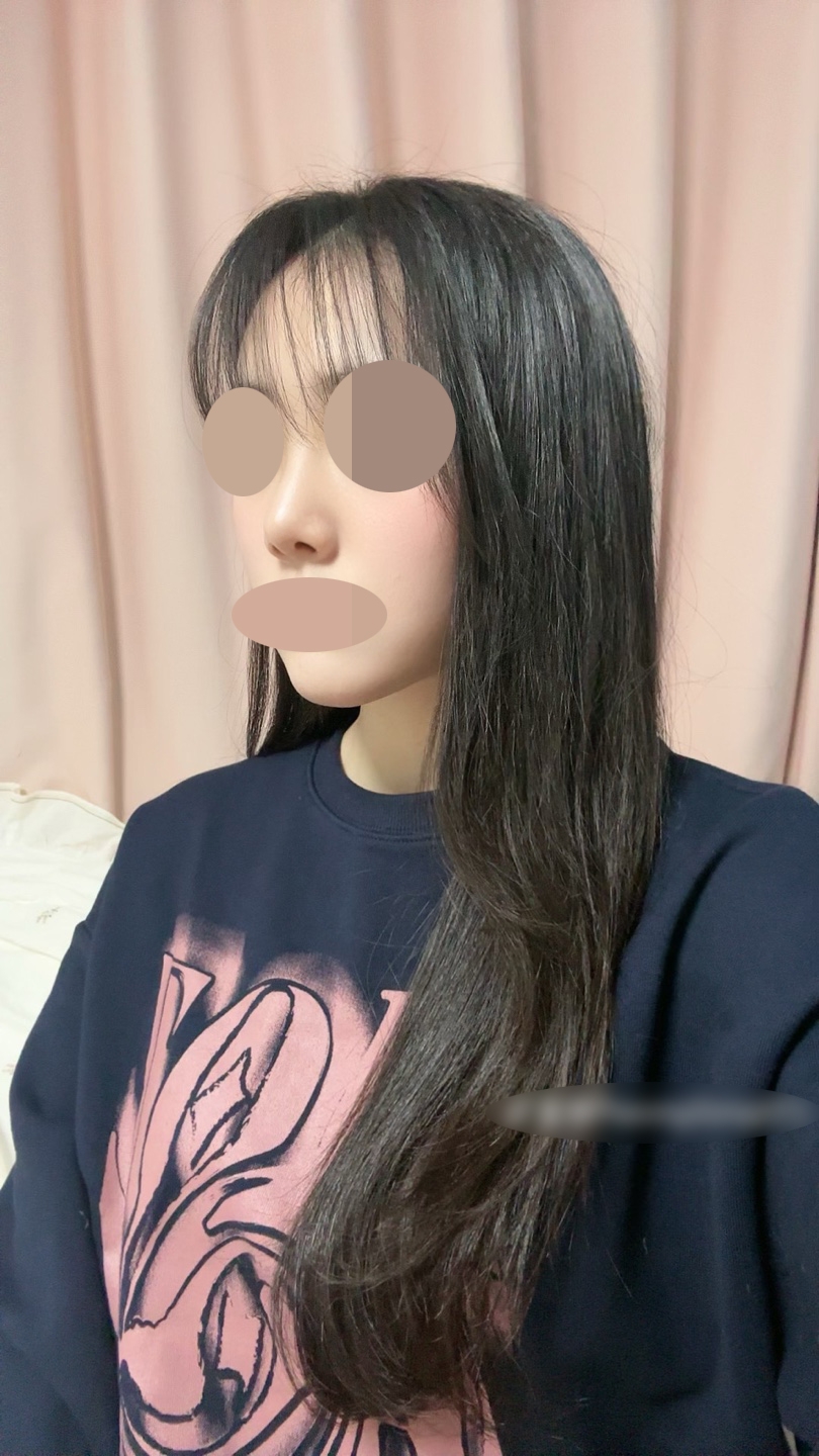 수술후기이미지