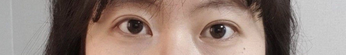 수술후기이미지