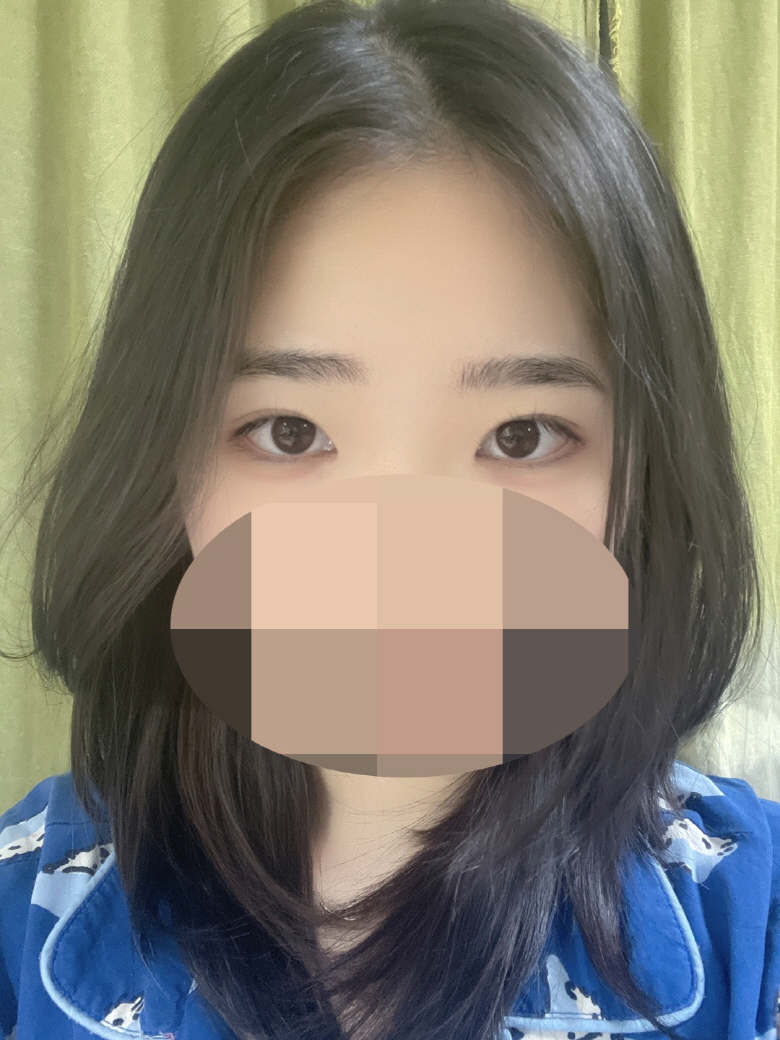 수술후기이미지