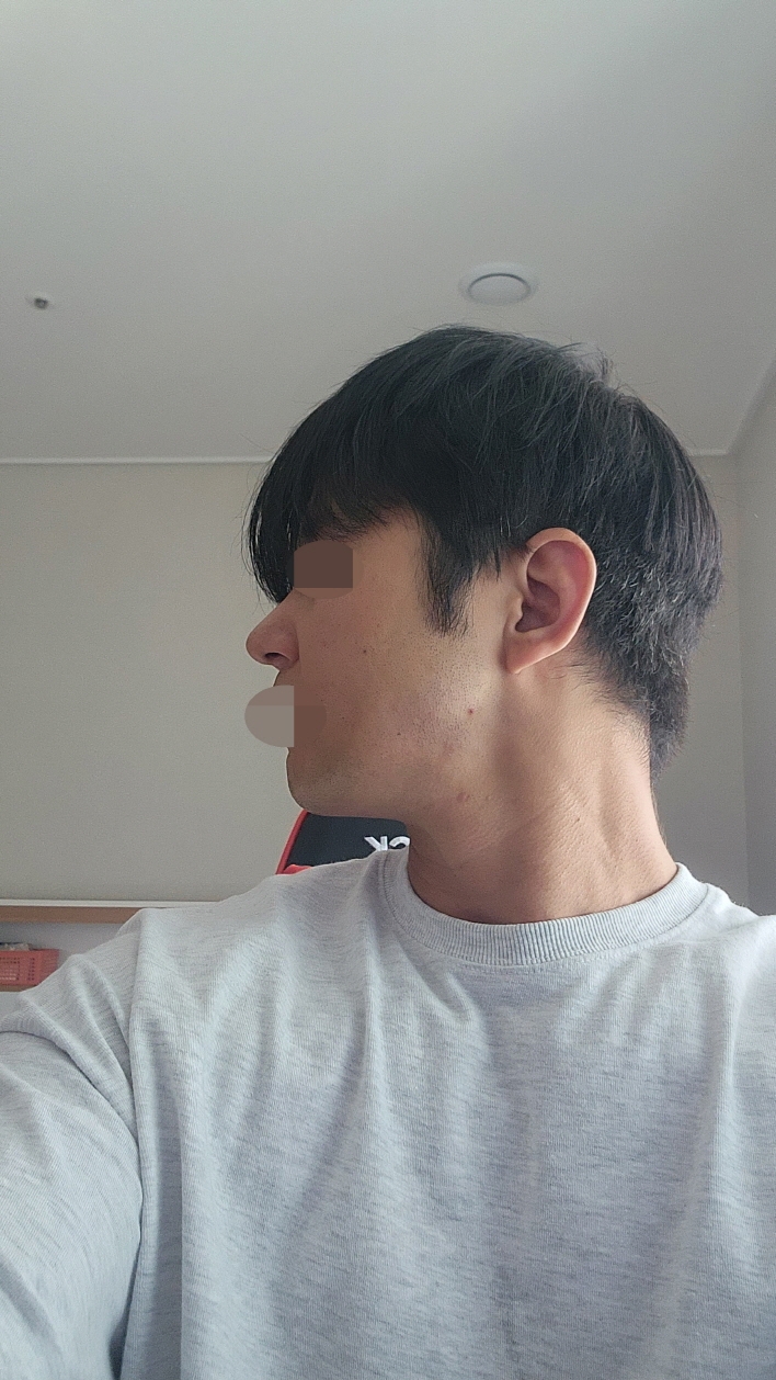 수술후기이미지