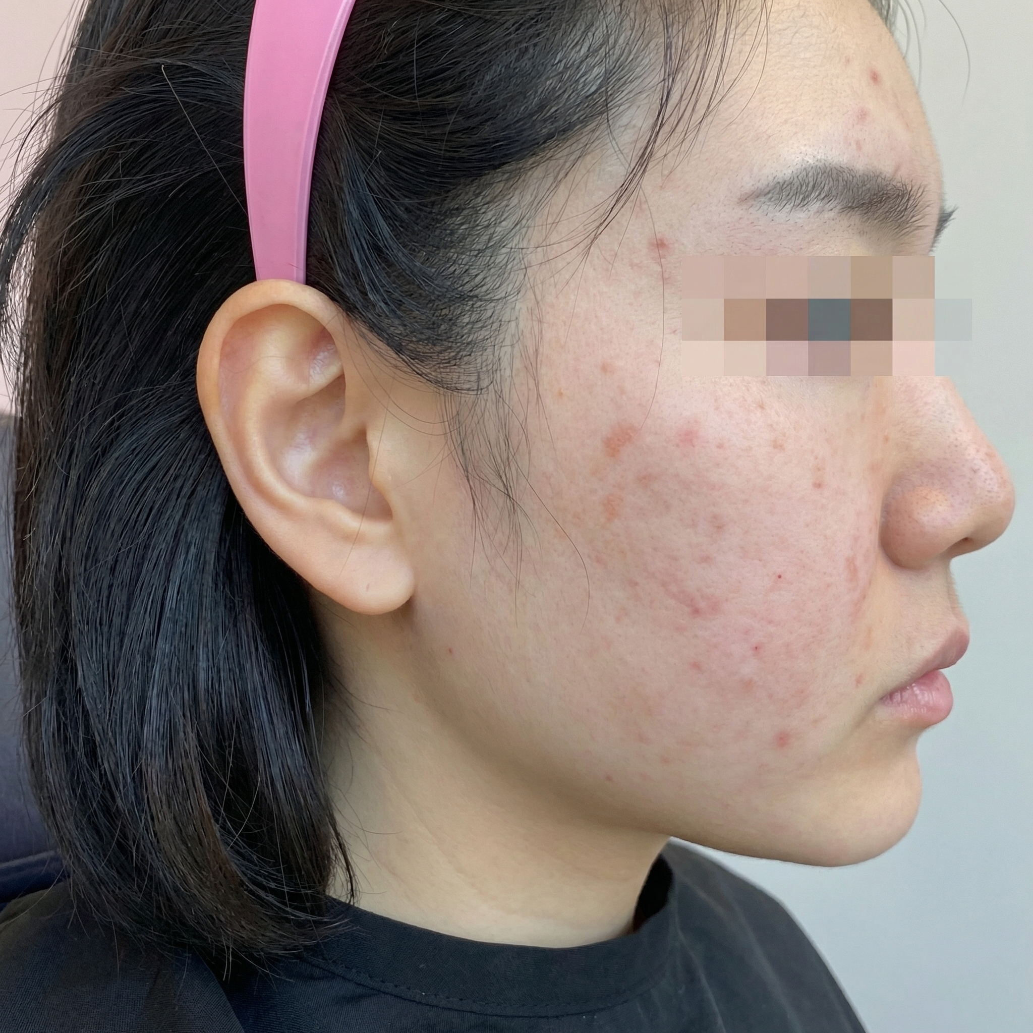 수술후기이미지