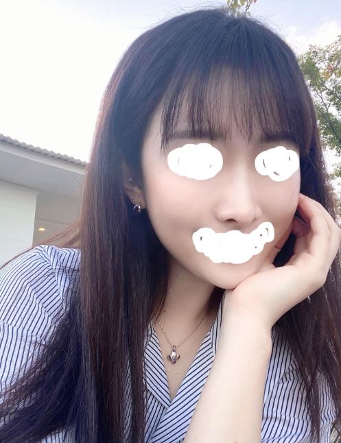 수술후기이미지