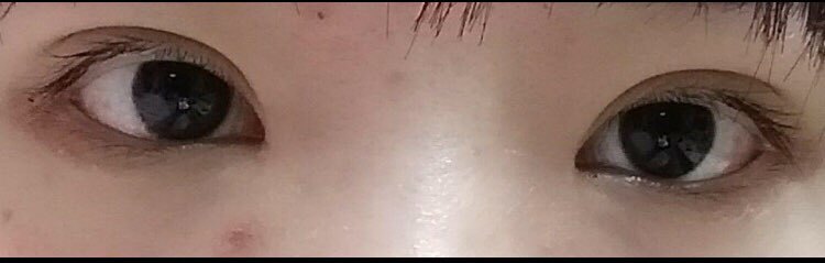 수술후기이미지