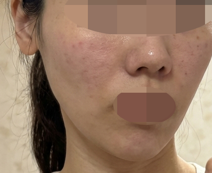 수술후기이미지