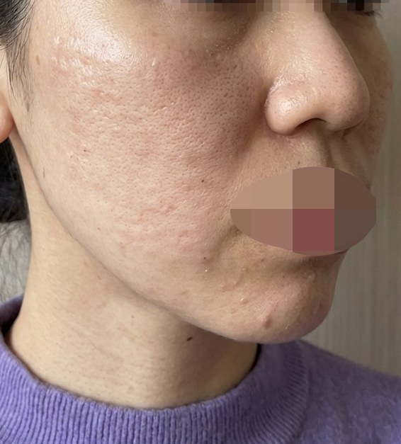 수술후기이미지