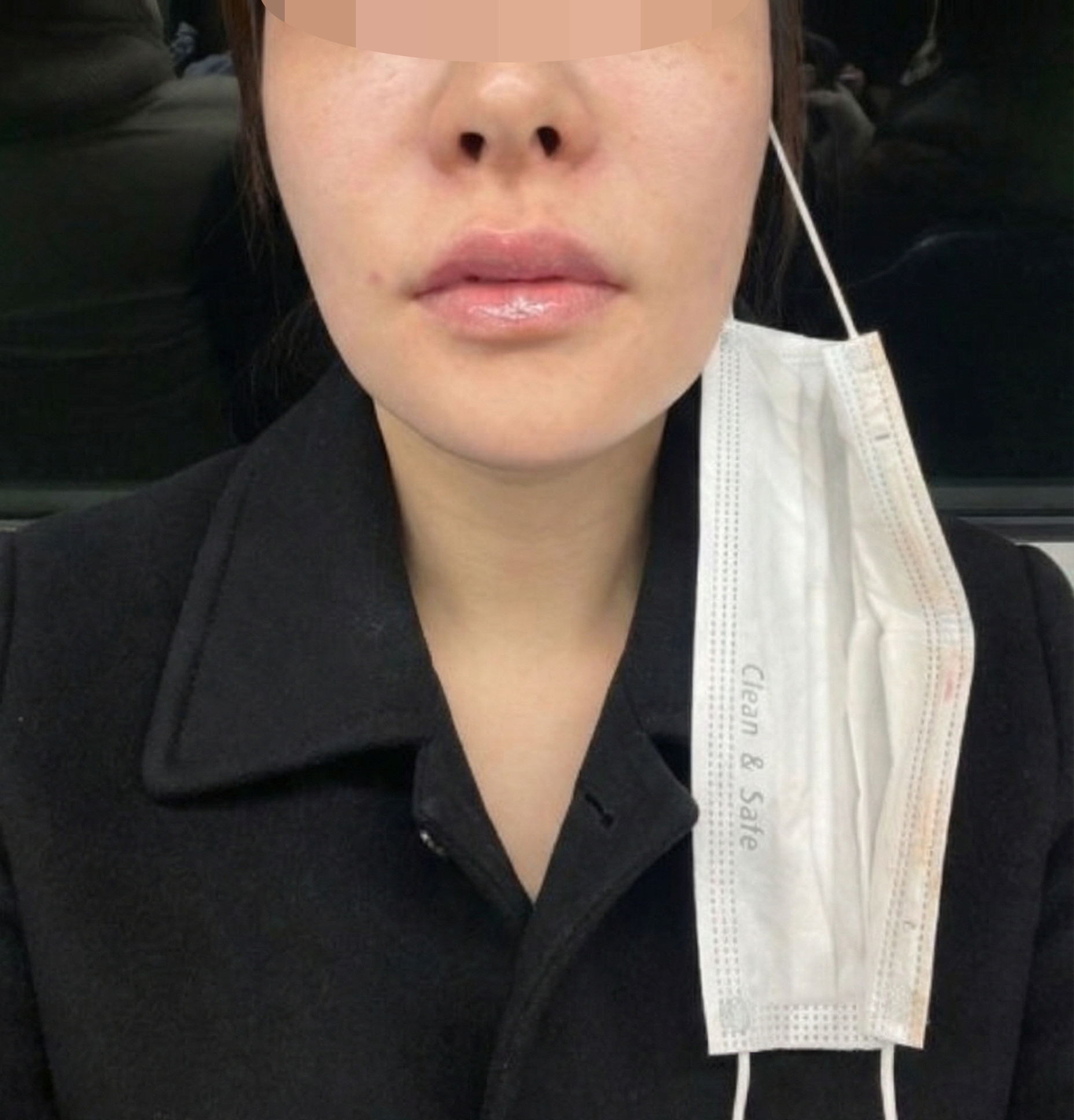 수술후기이미지