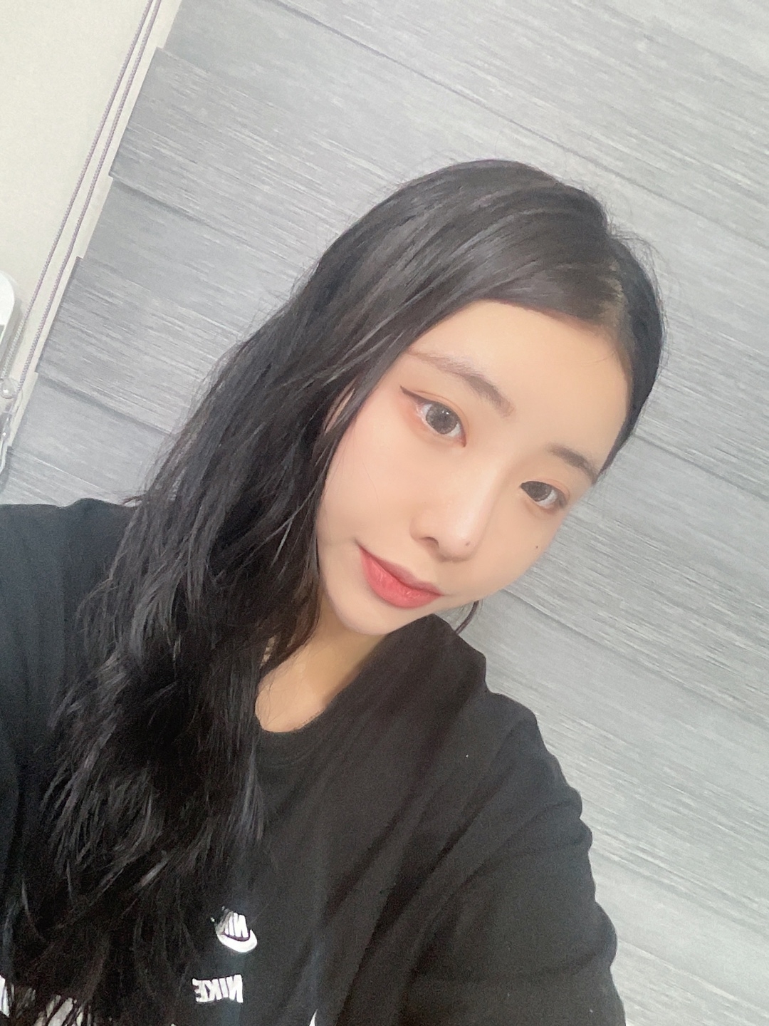 수술후기이미지