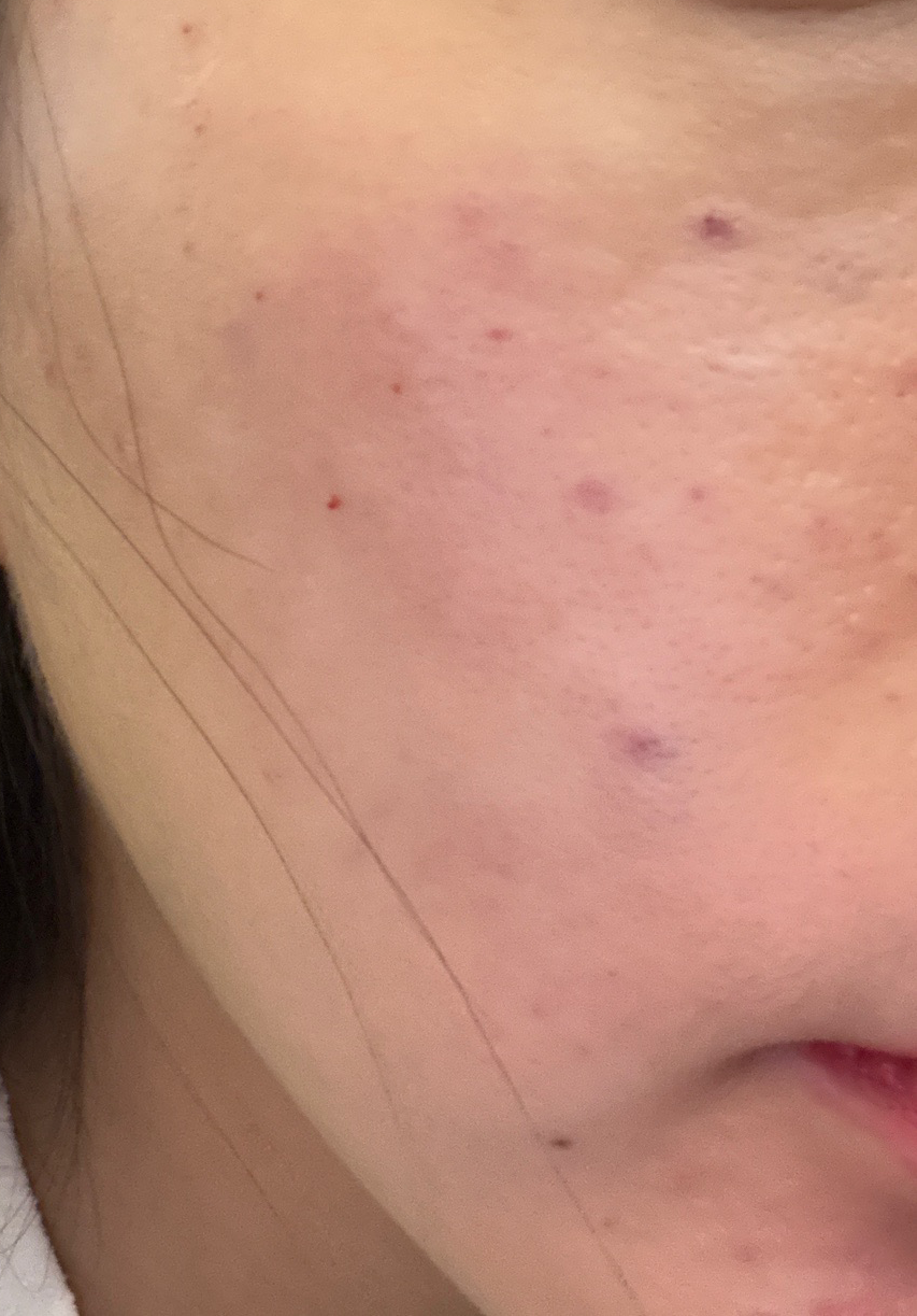 수술후기이미지