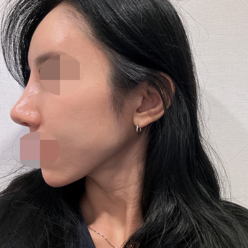 수술후기이미지