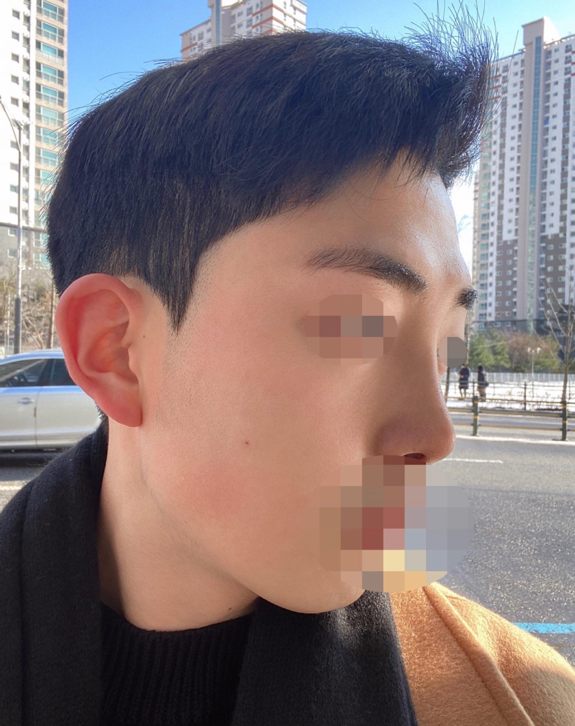 수술후기이미지