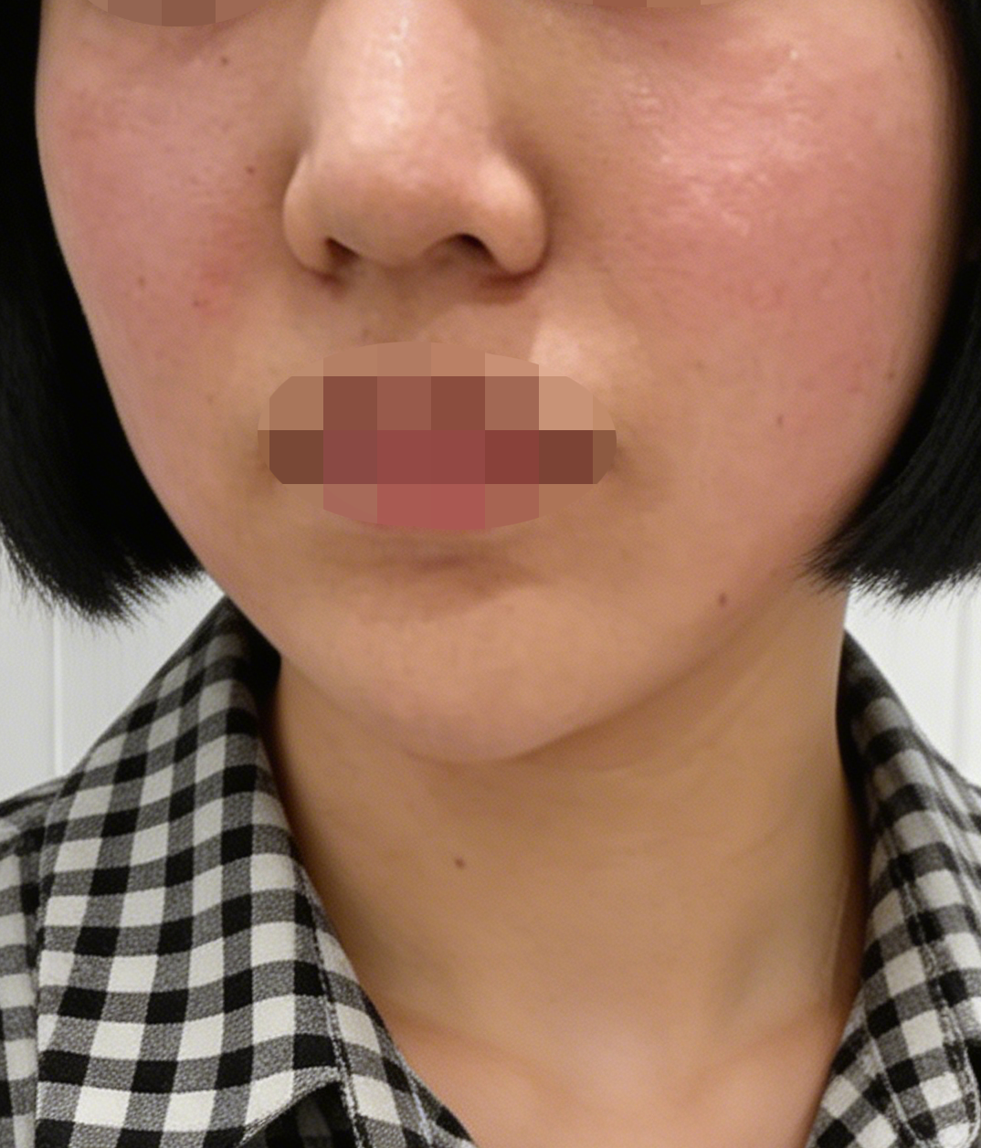 수술후기이미지