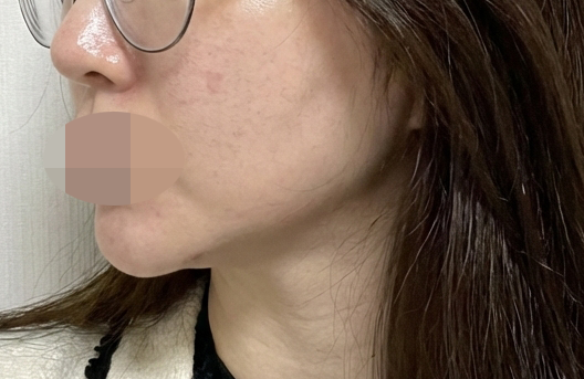 수술후기이미지