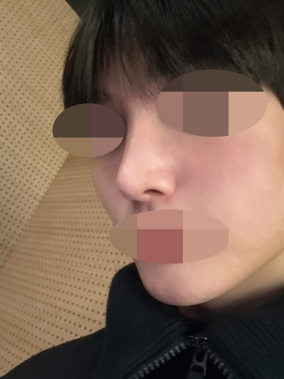 수술후기이미지