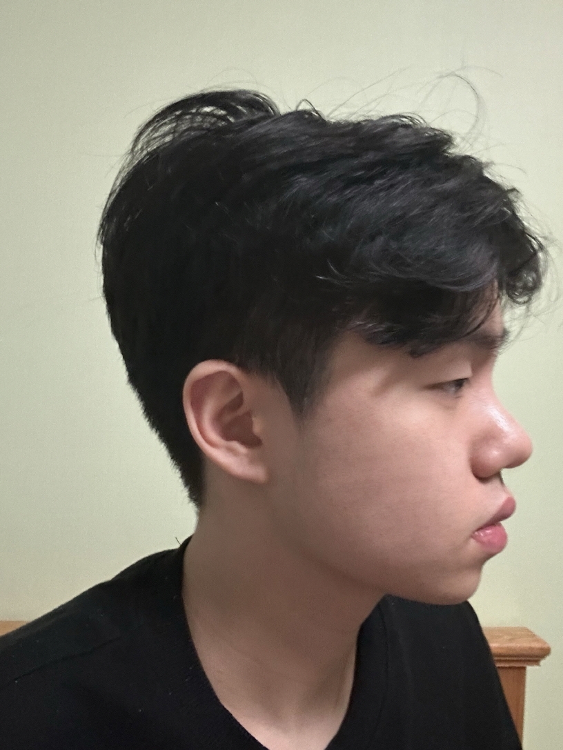 수술후기이미지