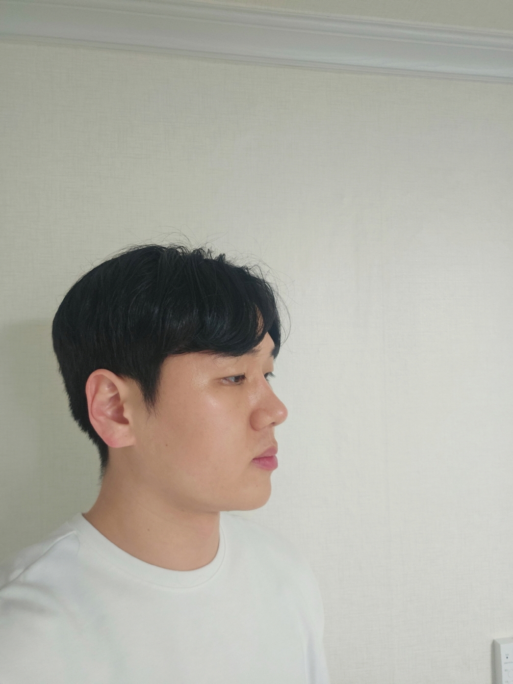 수술후기이미지