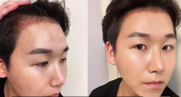 수술후기이미지