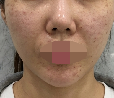 수술후기이미지