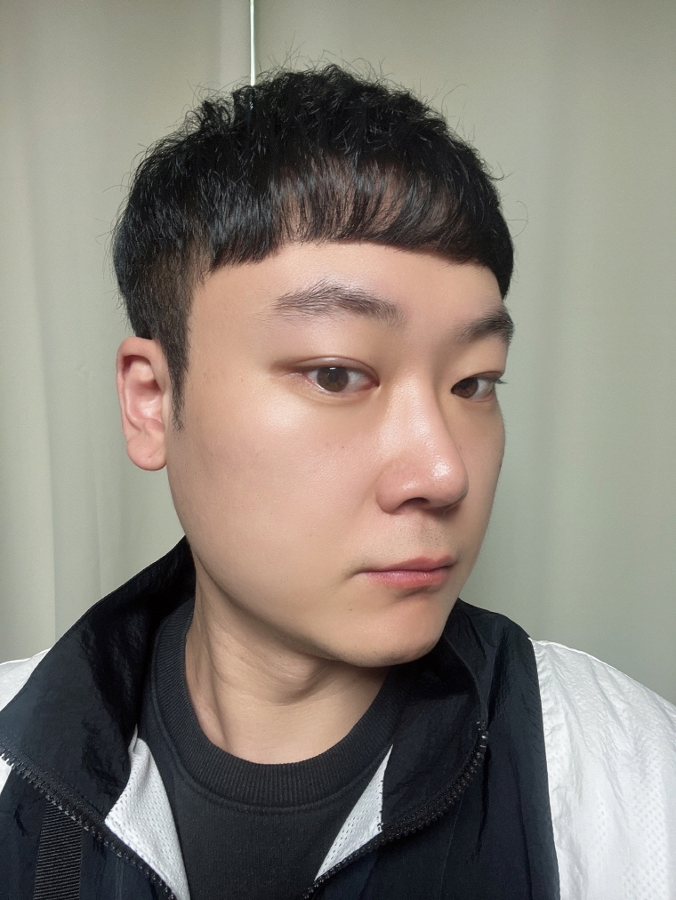 수술후기이미지